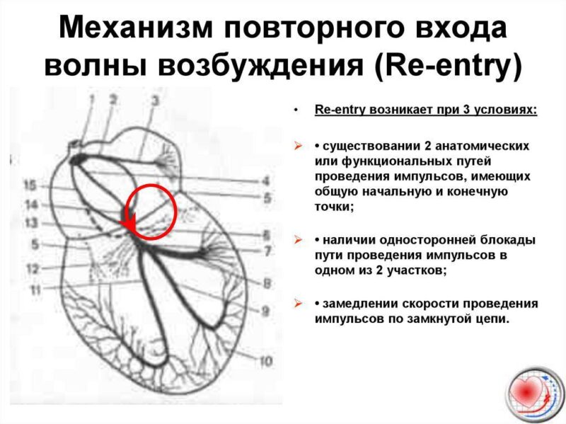 Это красное колечко надо разомкнуть. Для этого и проводится вагусный приём