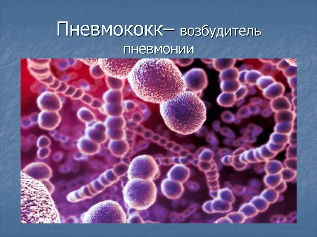 -4