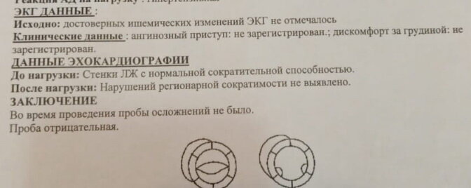 Отрицательное стресс-эхо с вероятностью более 05% свидетельствует в пользу того, что сосуды сердца в порядке.