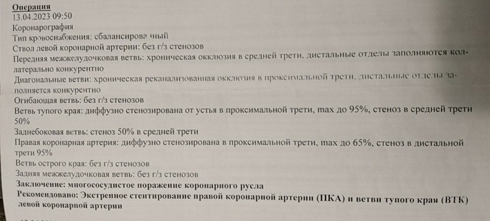 Только общий ствол и огибающая ветвь осталась без бляшек. 