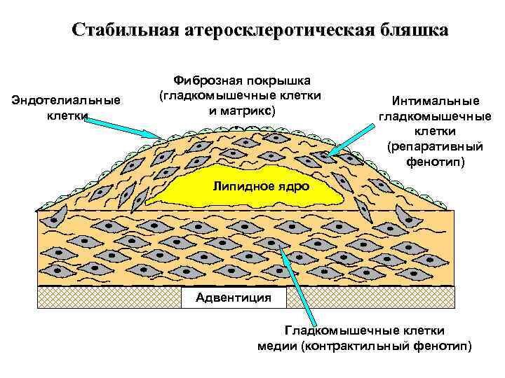 -3