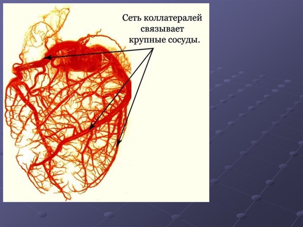 хорошо развитые коллатерали уменьшают риск